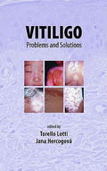Vitiligo: Problems And Solutions (Basic And Clinical Dermatology)