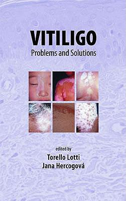 Vitiligo: Problems And Solutions (Basic And Clinical Dermatology)